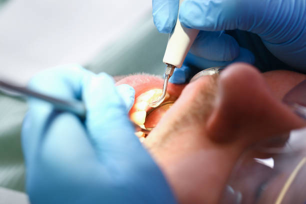 Best Mobile Emergency Dentist in Mullins, SC