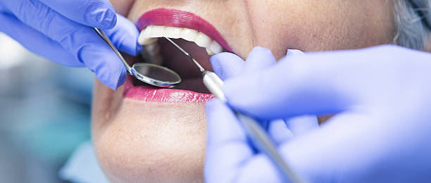 Best Emergency Dental Care for Abscessed Tooth in Mullins, SC